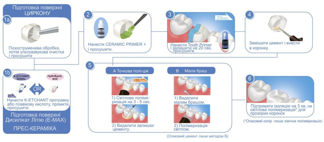 Фиксация циркония. Протокол фиксации безметалловой керамики. Фиксация коронки Emax протокол. Адгезивный протокол фиксации коронок.