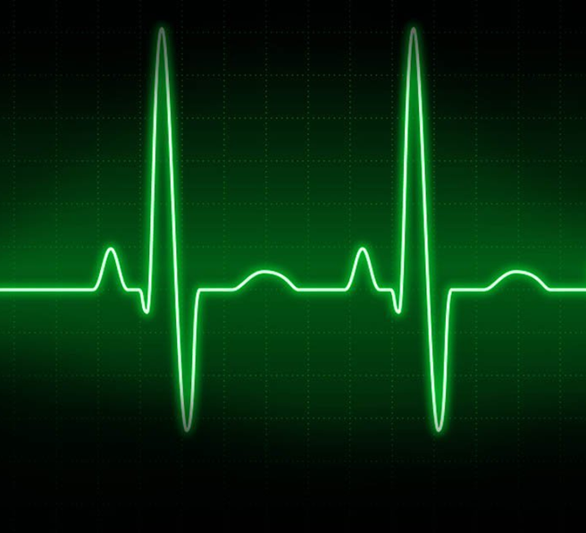 Звук для тренда. Кардиограмма сердца. Кардиограмма фон. Yurak EKG. Кардиограмма на белом фоне фото на аву.