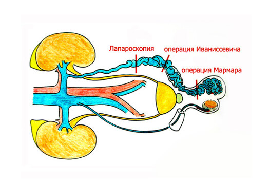 Операция мармара схема