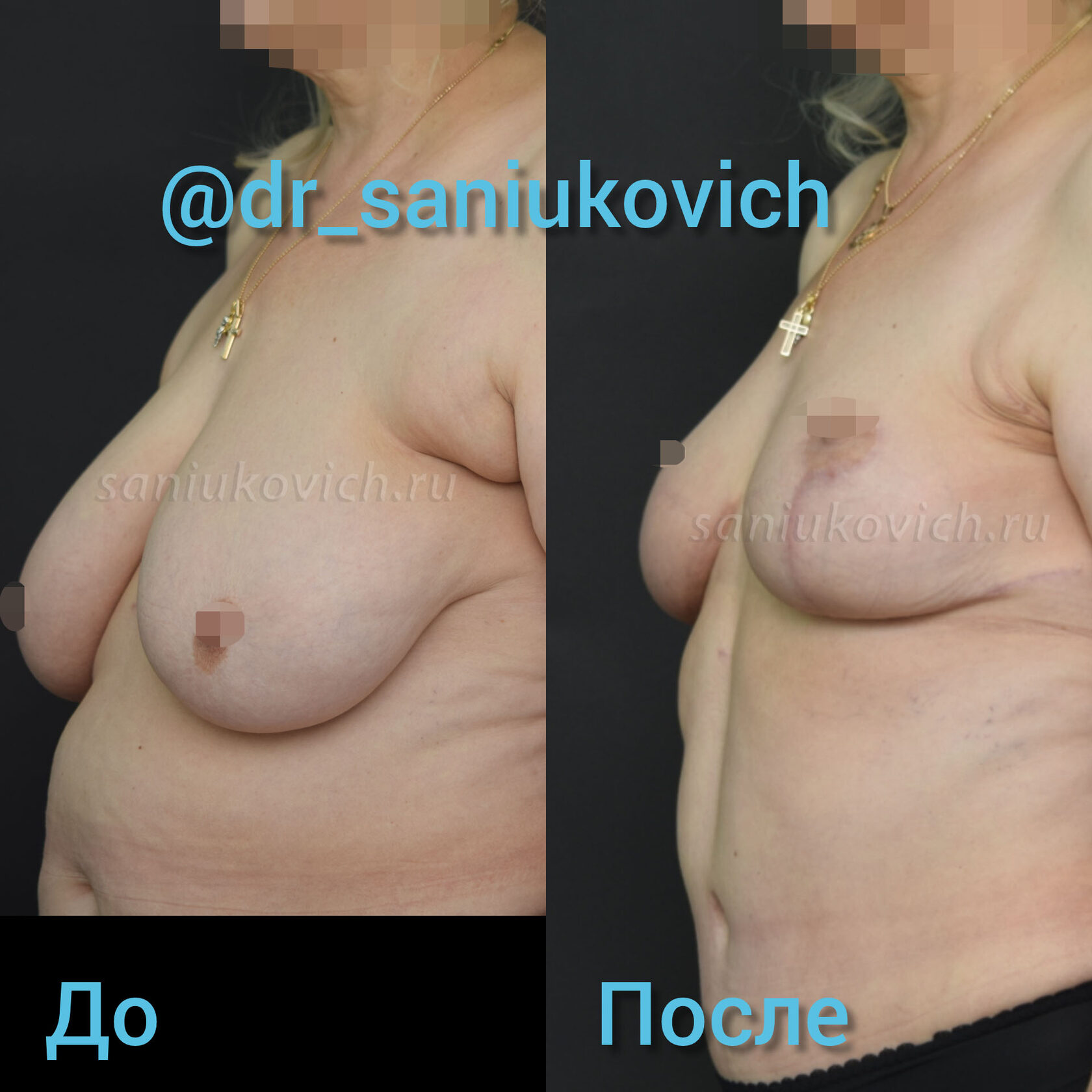упражнения на уменьшение груди у женщин фото 73