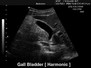 Tissue Harmonic Imaging (2-я гармоника)