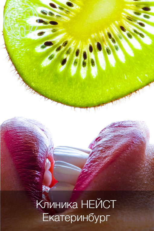 Керамические виниры в Екатеринбурге