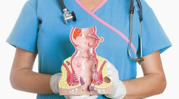 Доктор держит макет кишечника в руках