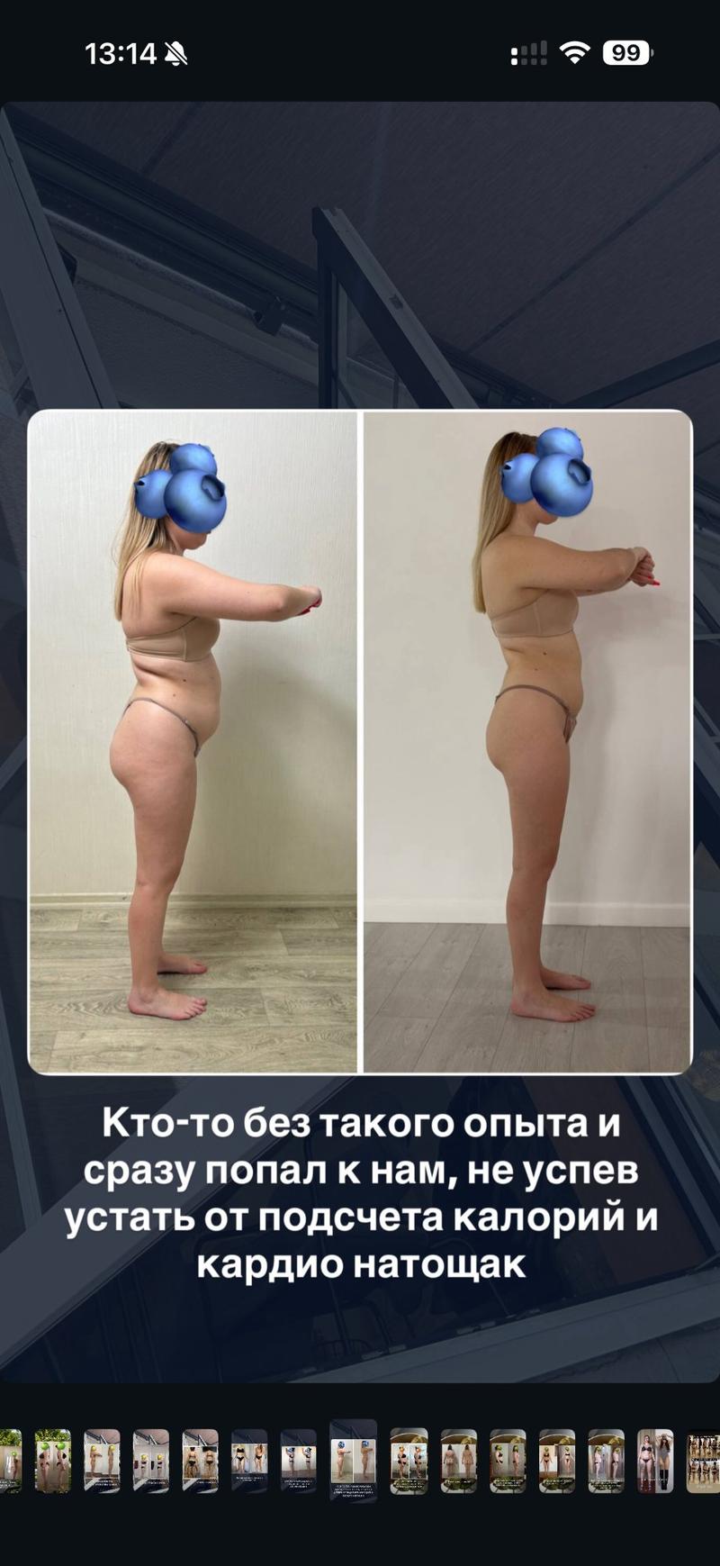 До и после ХМРЗ