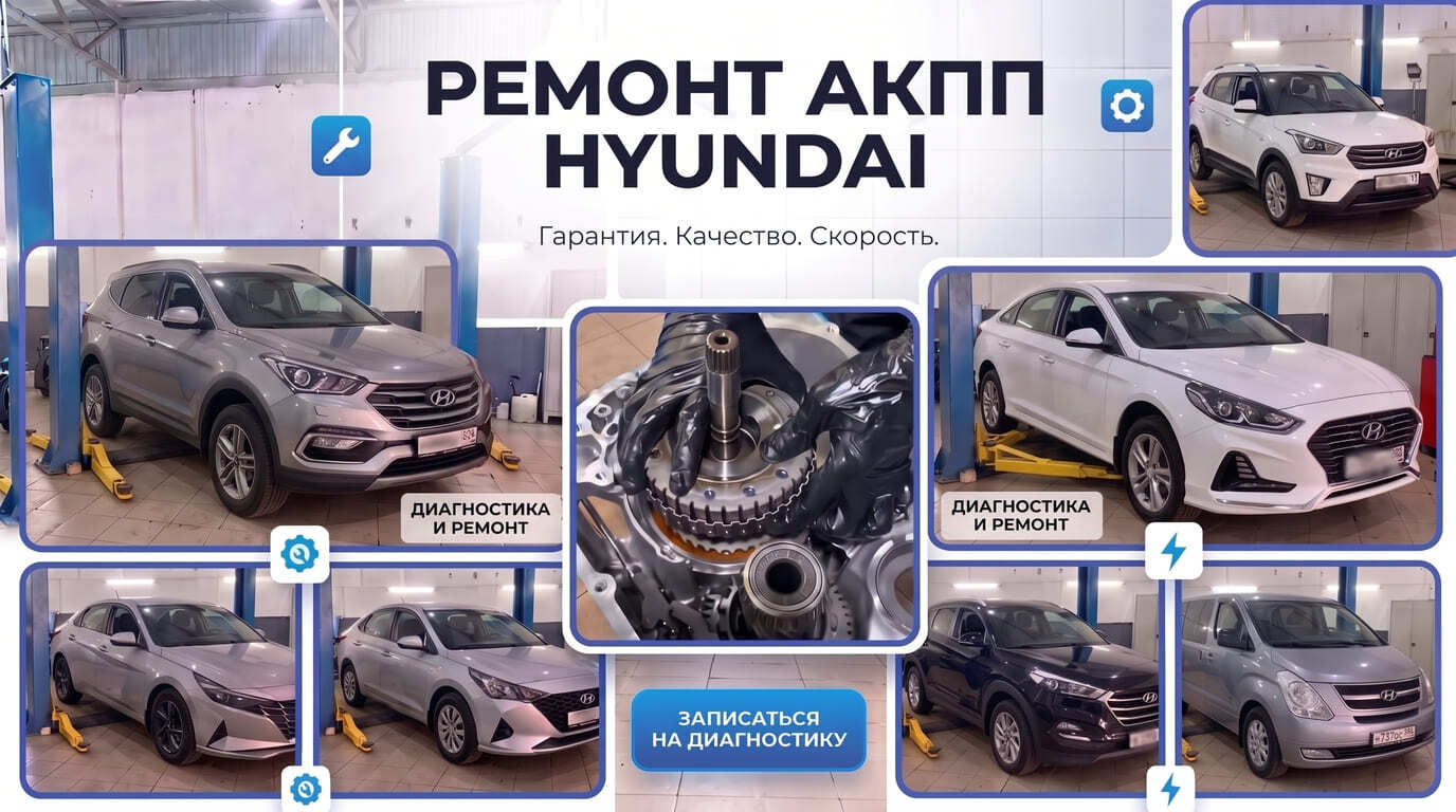 Ремонт АКПП Hyundai в автосервисе АКПП-Сервис в Москве