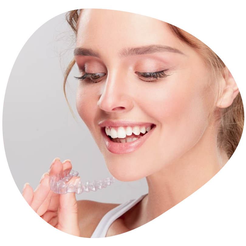 Элайнеры для выравнивания зубов | Стоматология «АЛЕКСАНДРиЯ»