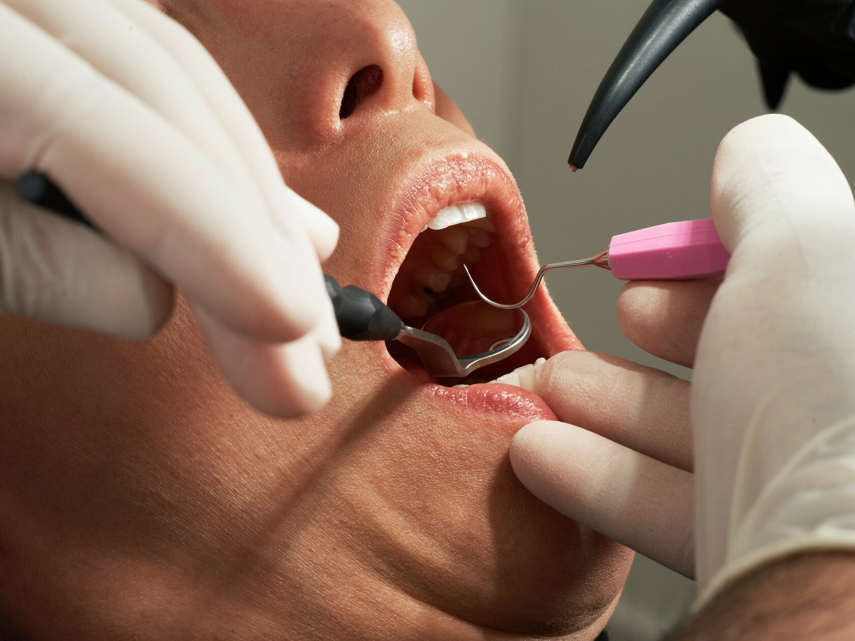 Procedure