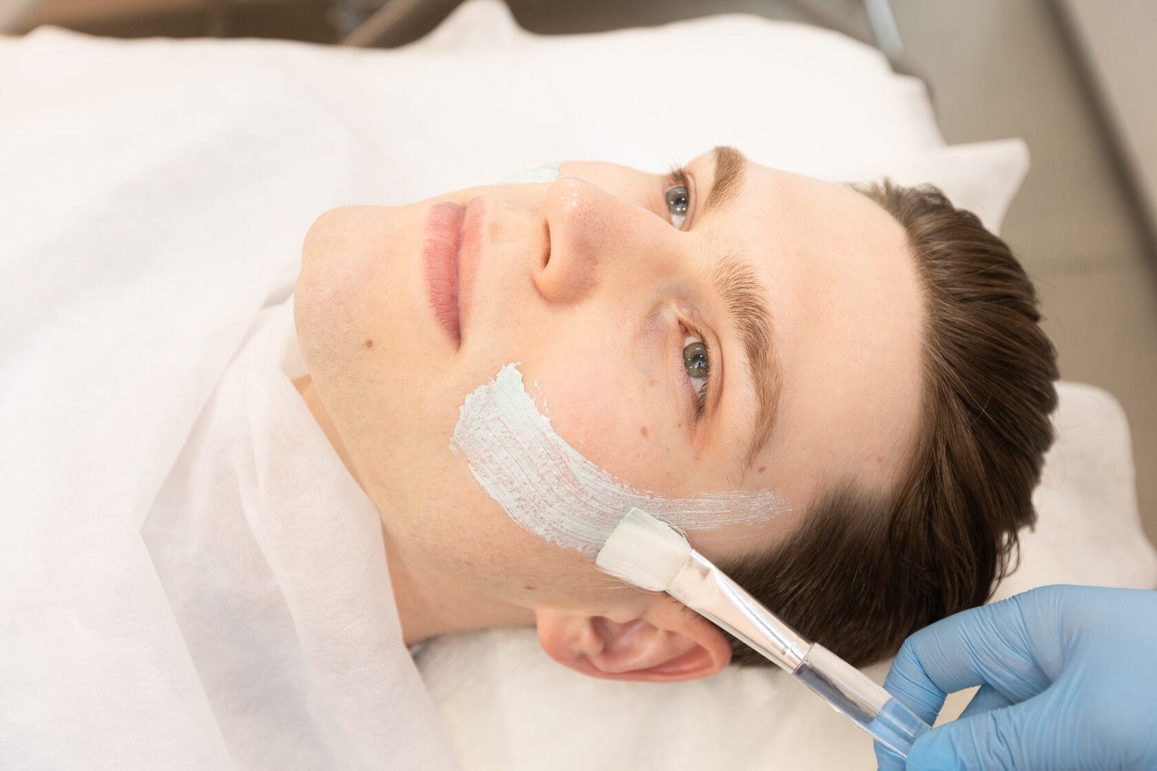 Уход за проблемной кожей при лечении акне в клинике «Лаванда», Екатеринбург