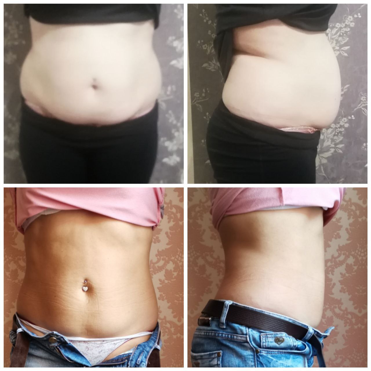 массаж_не_убирает_жир