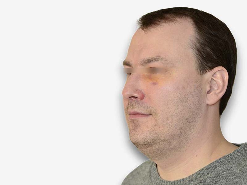 После