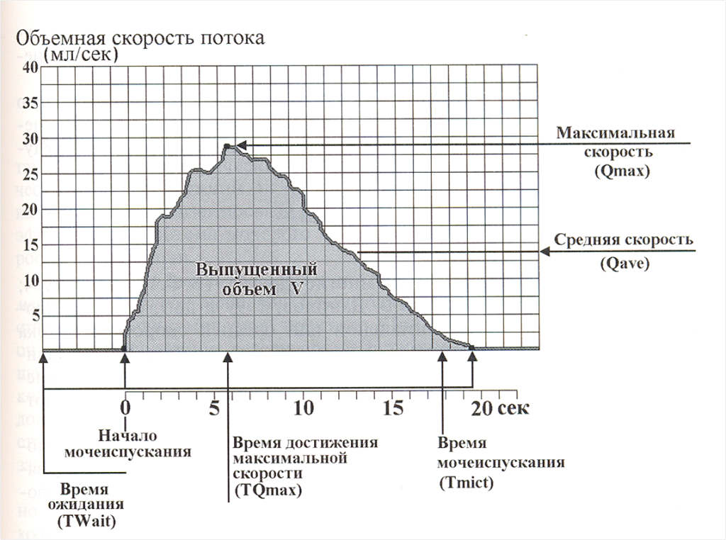 Напор мочеиспускания