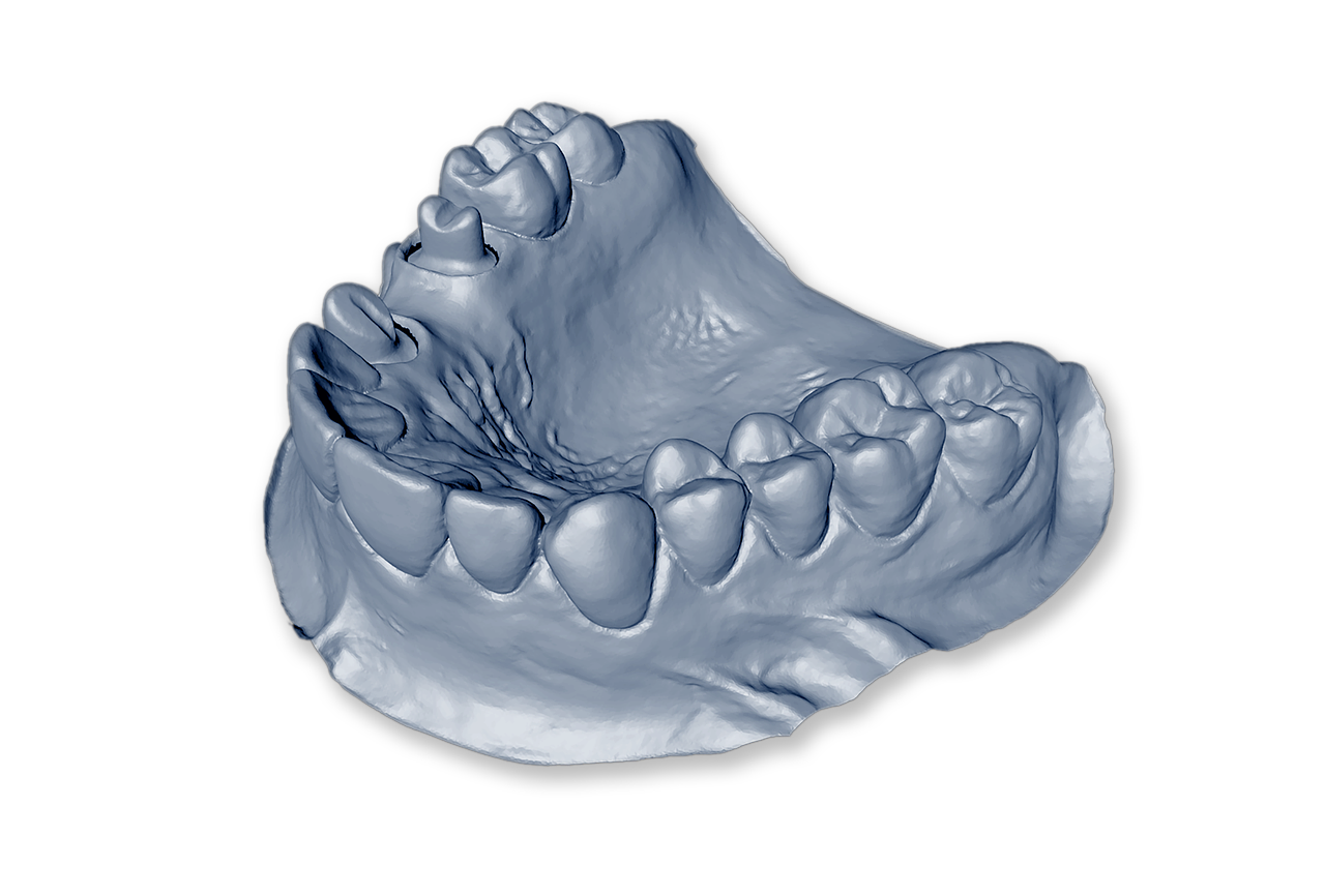 Нижняя челюсть 3d модель. Гипсовая модель зубов. 3д моделирование зубных протезов. Моделирование челюсти.