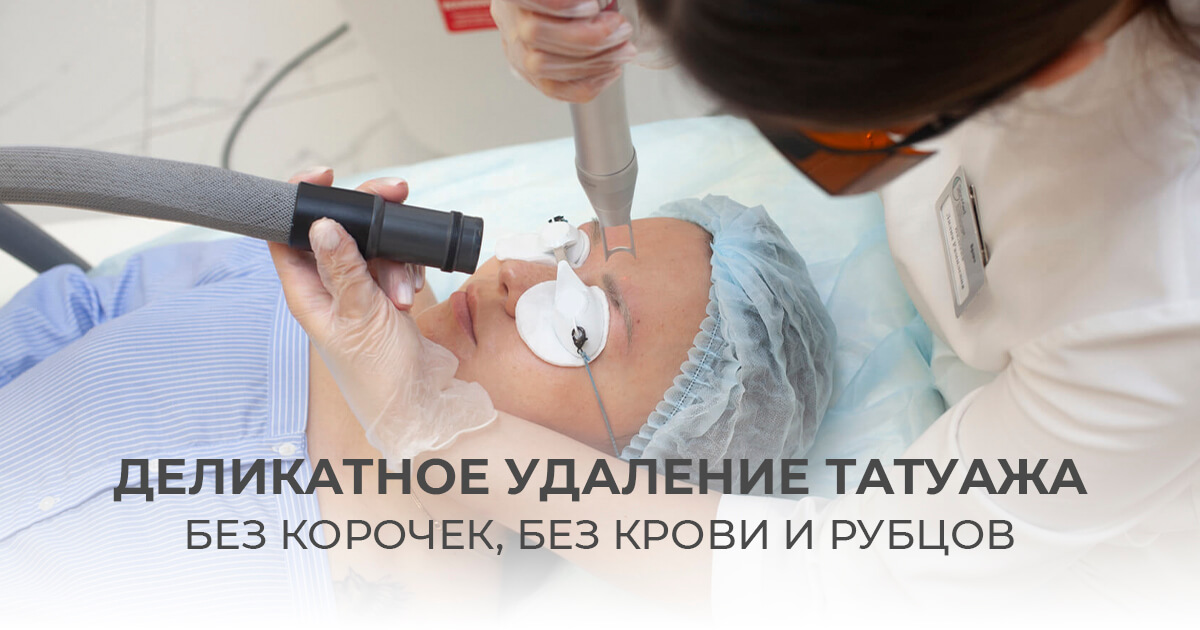 Удаление татуажа, цены в Казани - быстро и эффективно удаляйте старый ...