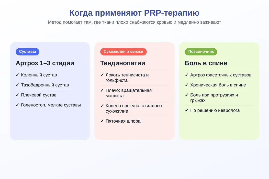 Показания к PRP-терапии: артроз, тендинопатии, боль в спине