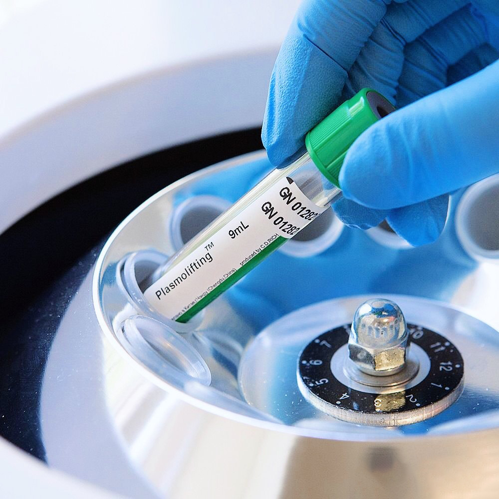 Плазмолифтинг