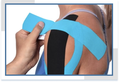 Кинезиотейпирование