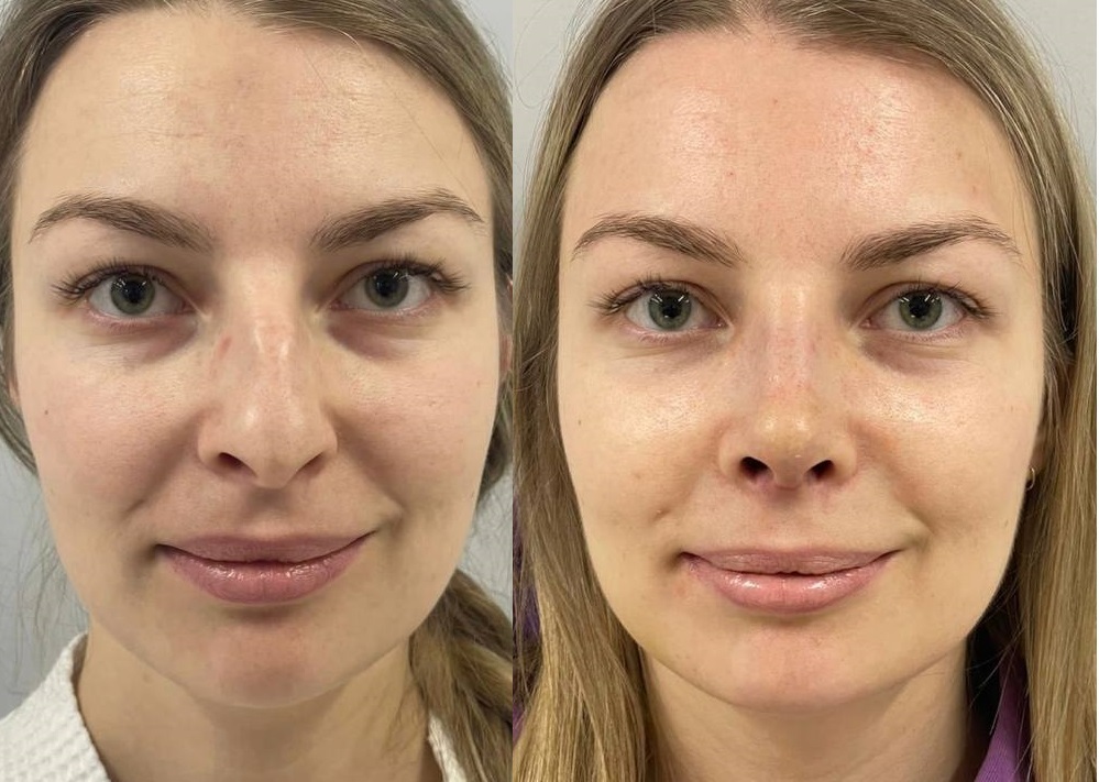 Хирург ринопластика москва