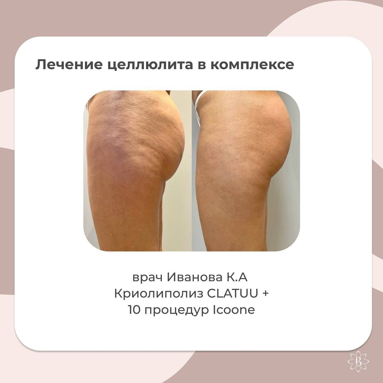 Результаты методики CLATUU