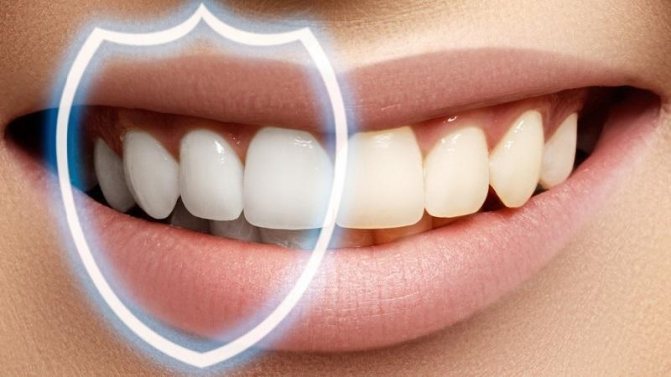 Полировка и шлифовка поверхностей зубов – что это такое и зачем нужно