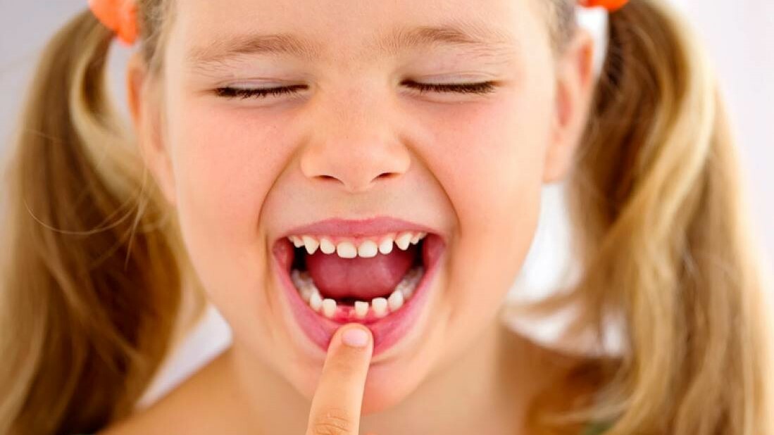 Шатается зуб - что делать и как лечить?