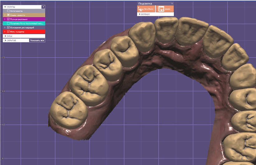 CAD/CAM-решения в зуботехнической лаборатории ELKO