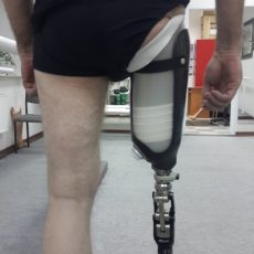 Крепление протезов бедра. 3. Крепление протезов бедра. Модульный протез голени с культеприёмной гильзой. Крепление протезов бедра.