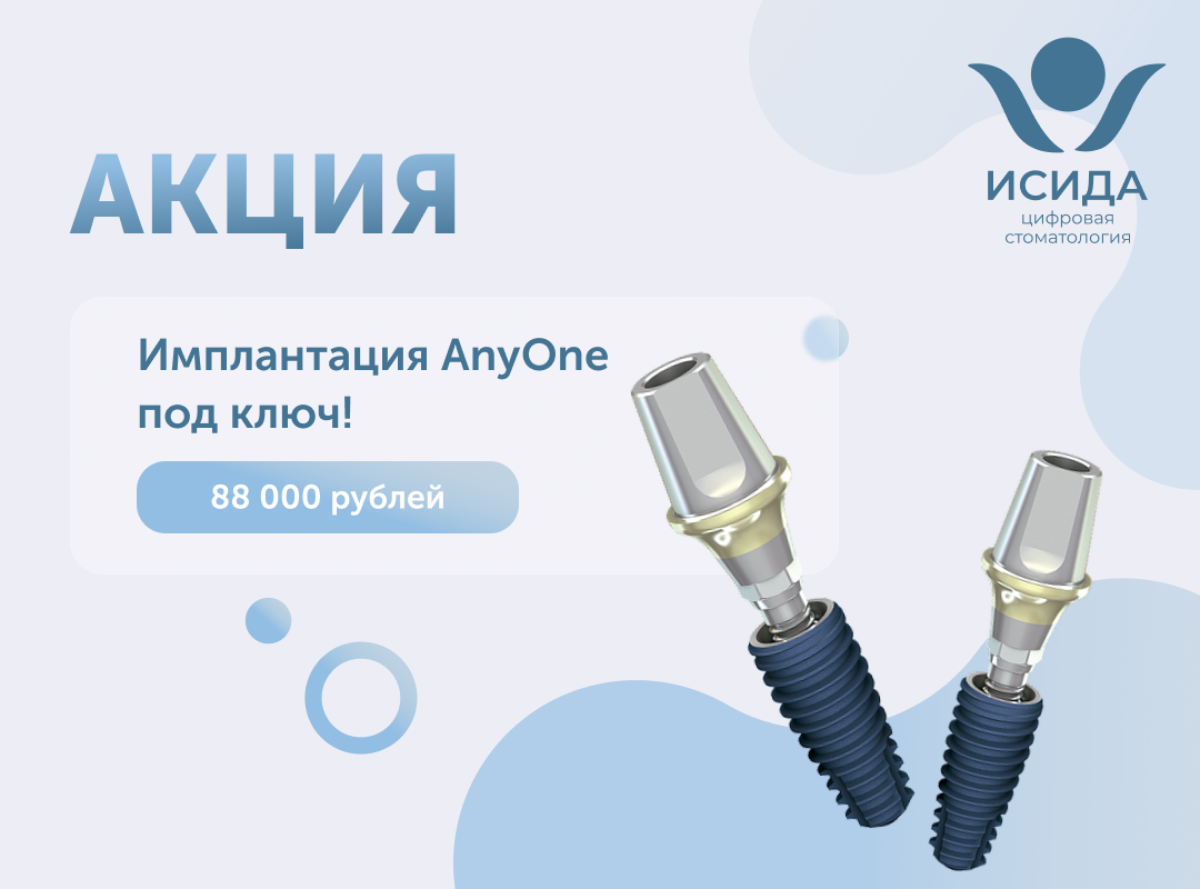 Импланты AnyOne