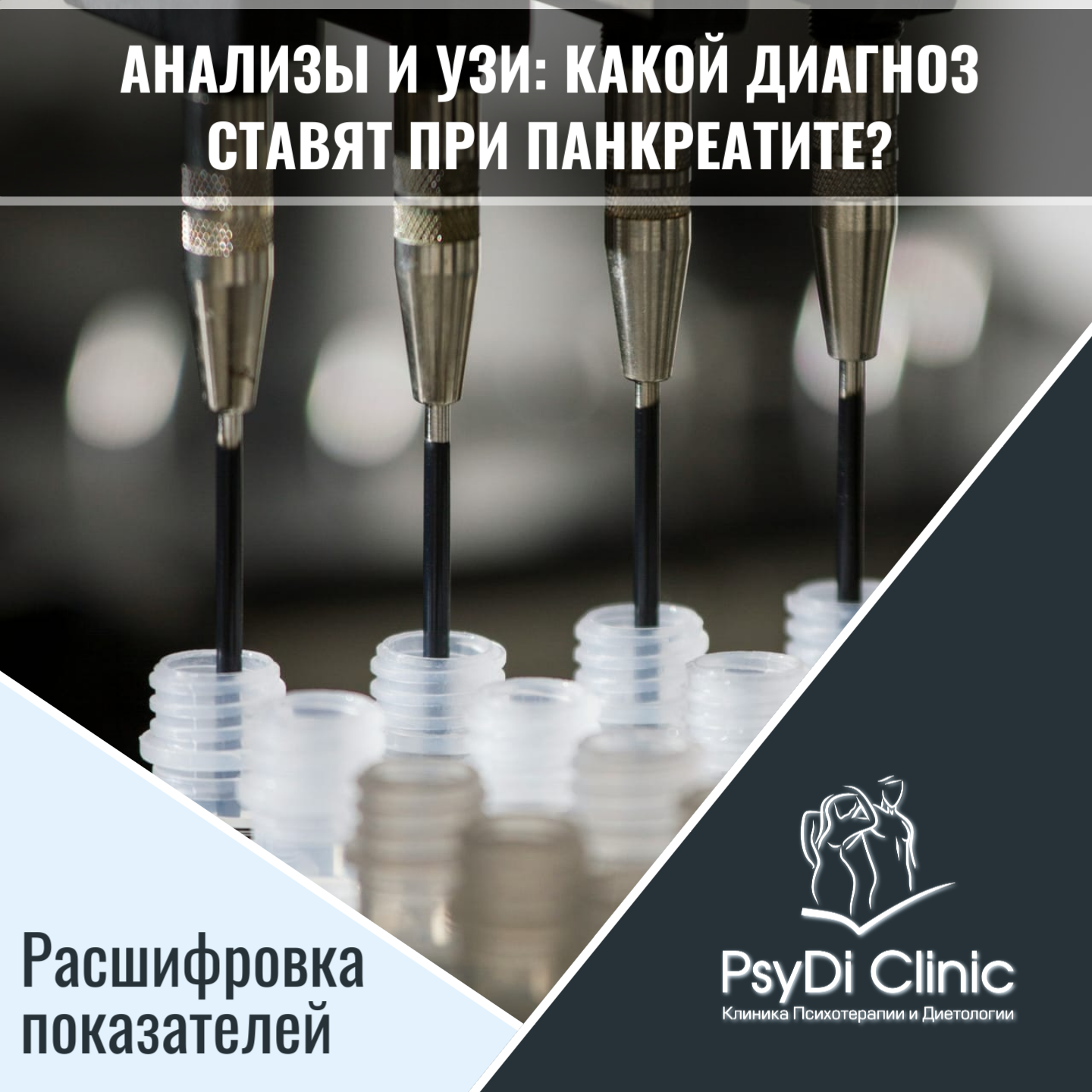 Анализы и УЗИ: какой диагноз ставят при панкреатите? Расшифровка показателей ��