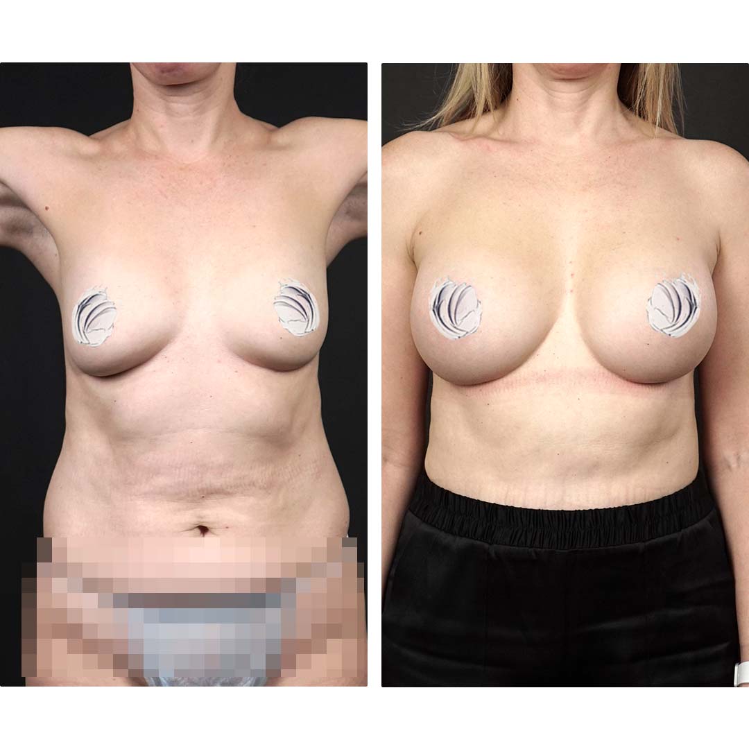 стимуляция груди у женщин фото 38