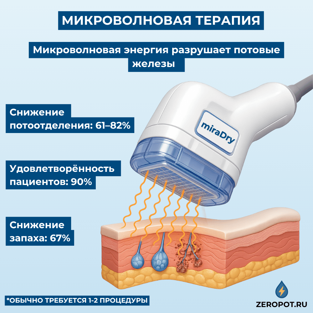 Микроволновая терапия miraDry разрушает потовые железы и снижает потоотделение