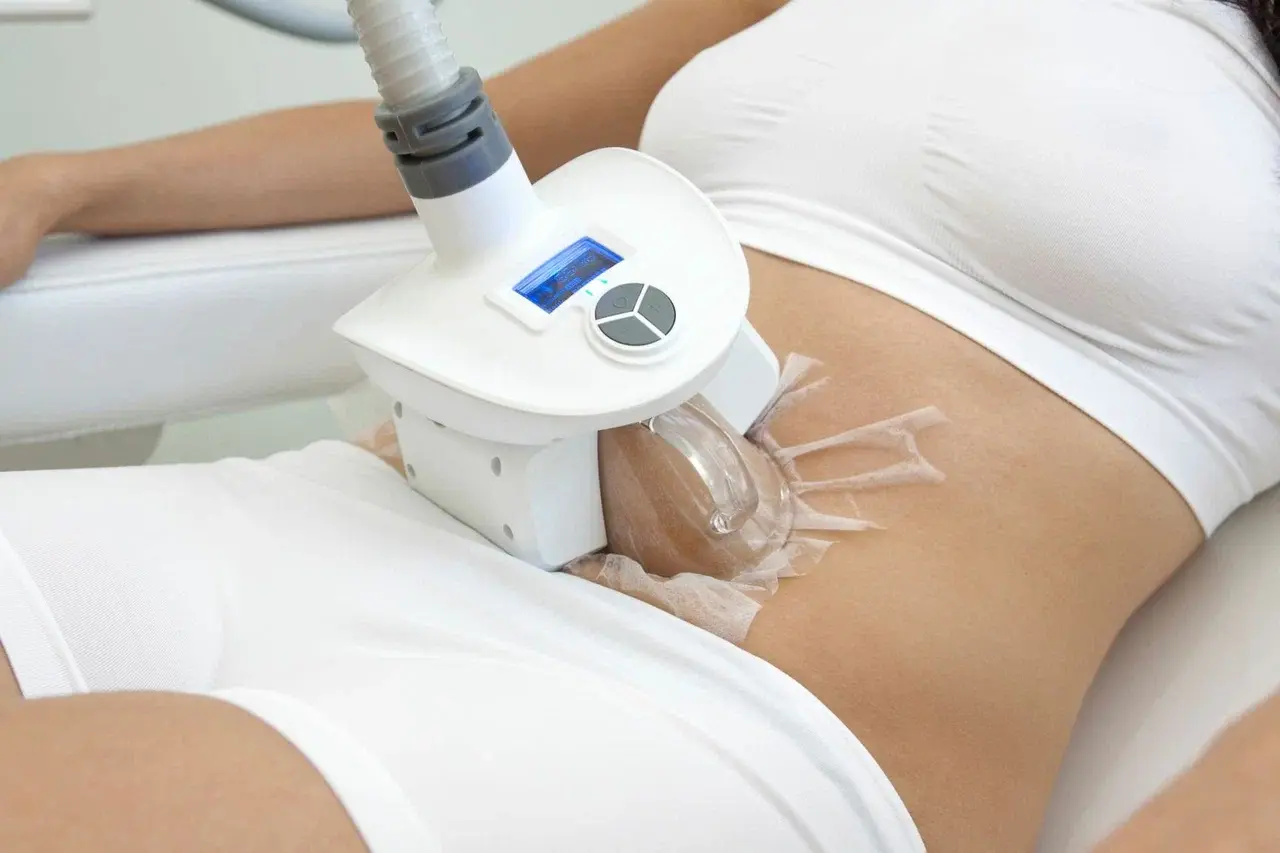 Криолиполиз