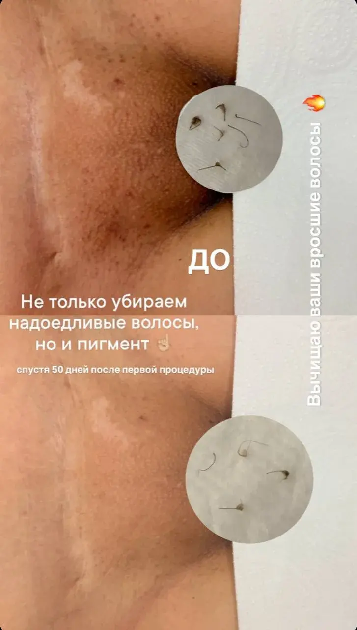 Деталь процедуры