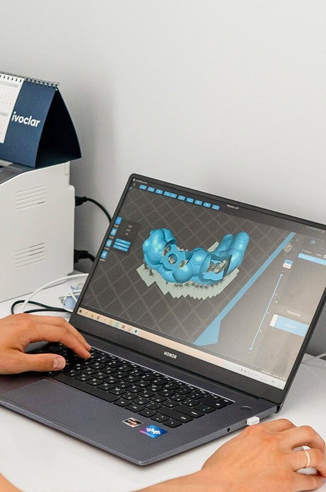 как работают элайнеры — 3D-план лечения на экране