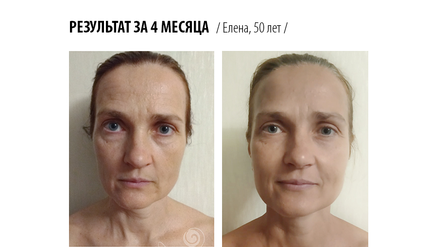 двенадцать месяцев: сказки. лицо на разные объективы. искажение объектива. месяцев привела лицо в. проснулся с опухшим лицом.