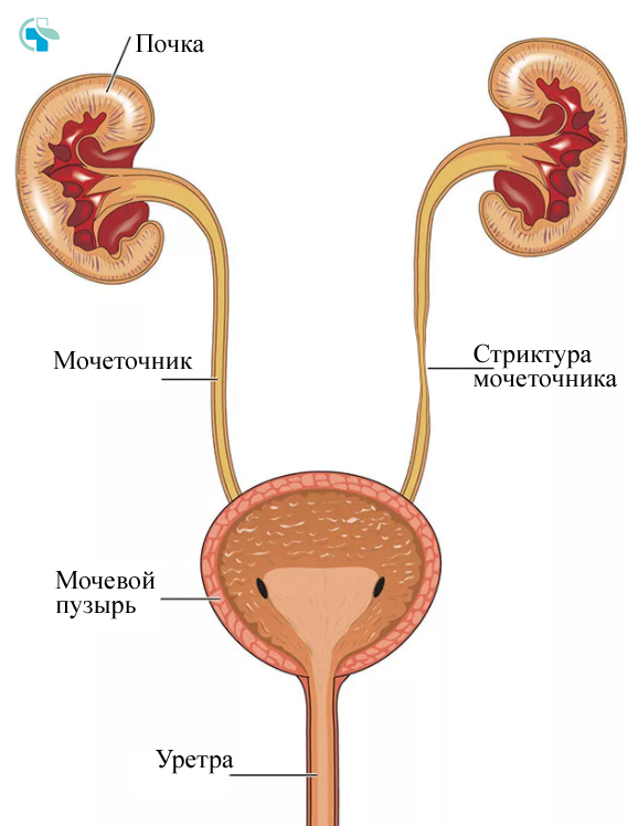 Лечение заболеваний почек и мочеточника - симптомы и диагностика