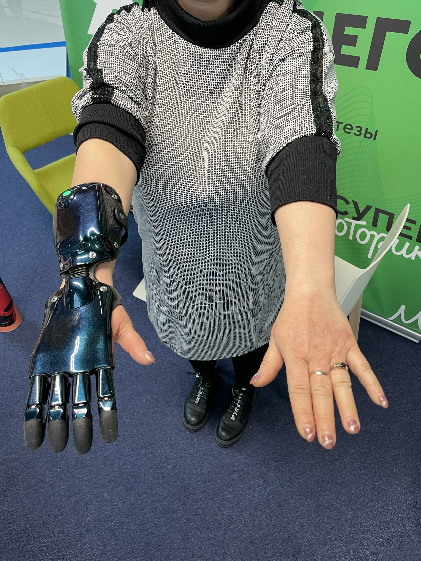 Бионический протез руки