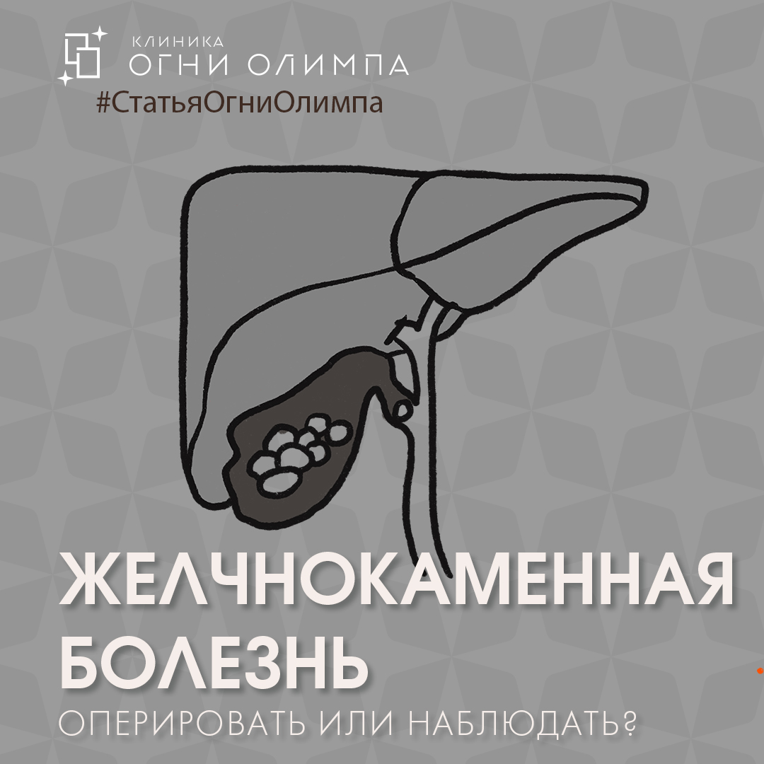 Желчнокаменная болезнь (ЖКБ) желчного пузыря - признаки, симптомы, лечение