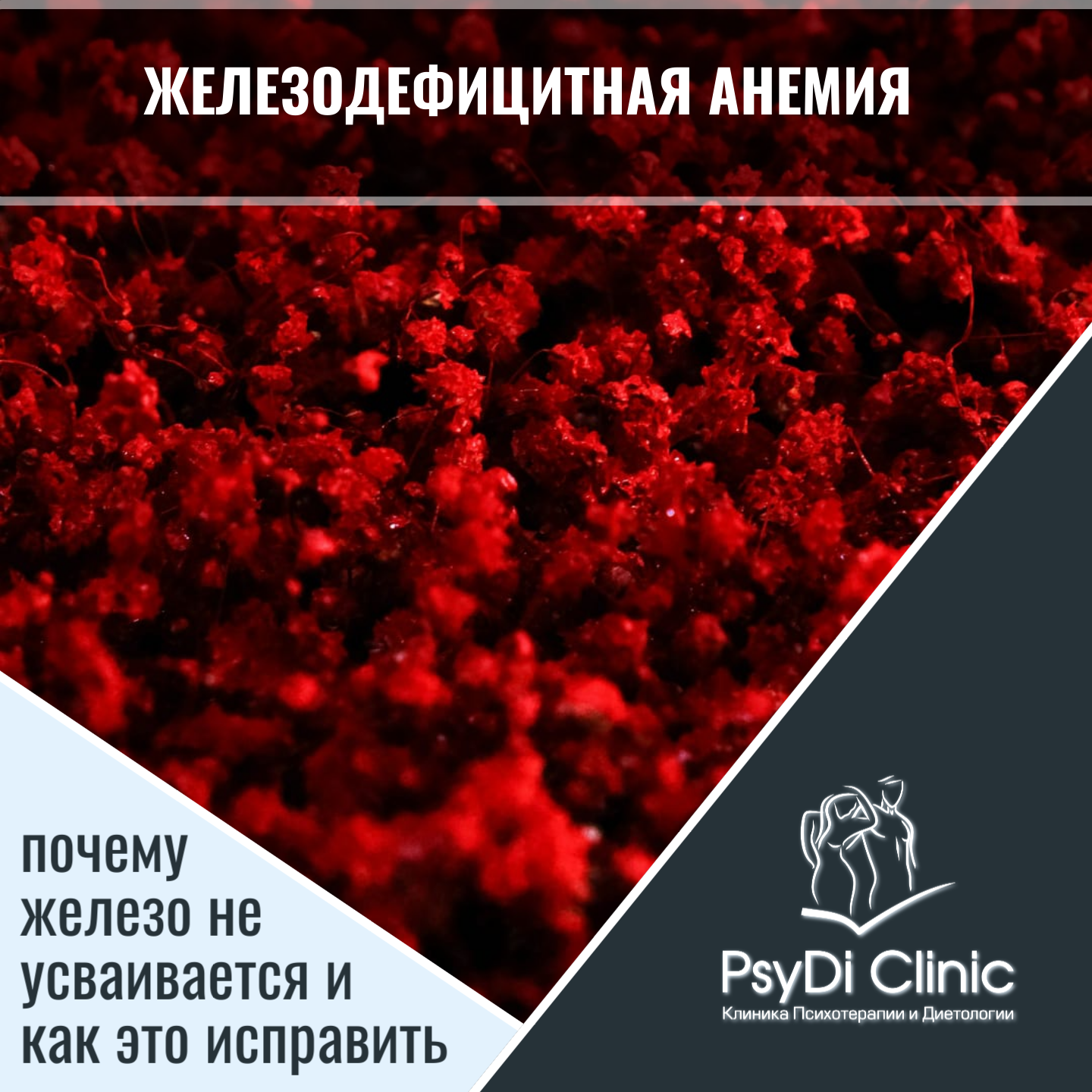 Железодефицитная анемия: почему железо не усваивается и как это исправить ��