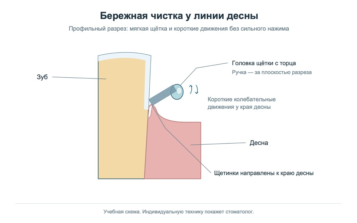 Бережная чистка у линии десны: щетинки мягкой щётки направлены к краю десны