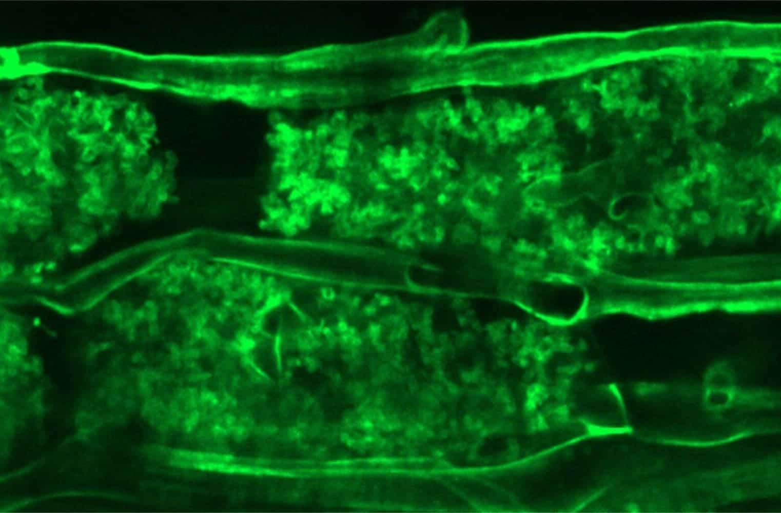 Мицелий в клетках корня Lotus japonicus / © Science Advances (2026). DOI: 10.1126/sciadv.aec5607