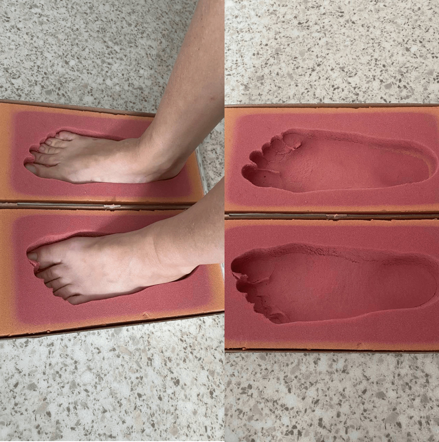 стельки для стопы