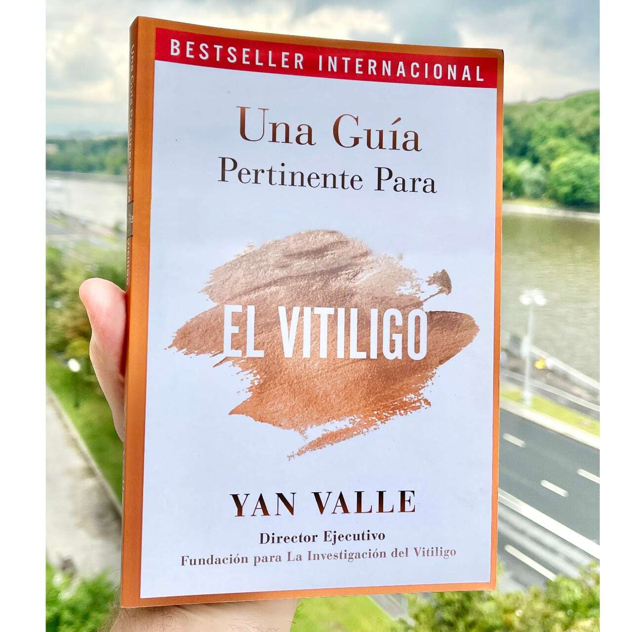 A No-Nonsense Guide To Vitiligo eBook by Yan Valle - EPUB Book