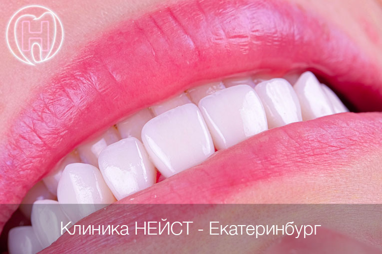 керамические виниры Эстетик цвет Блич 3 (Bleach3)