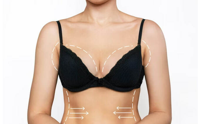 Подтяжка лишней кожи на груди