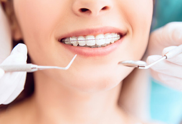 Керамические брекеты в Красногорске — стоматология Эволюция