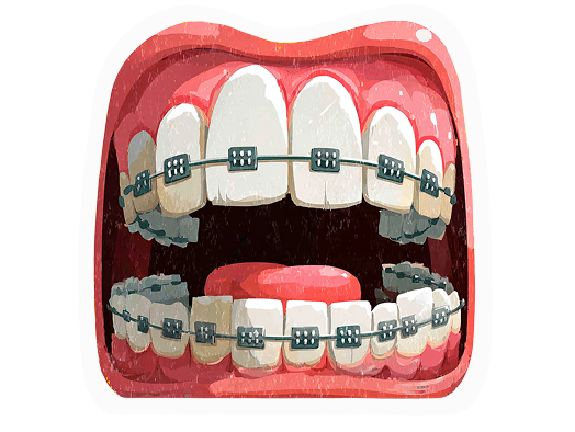 рот с брекетами на зубах
