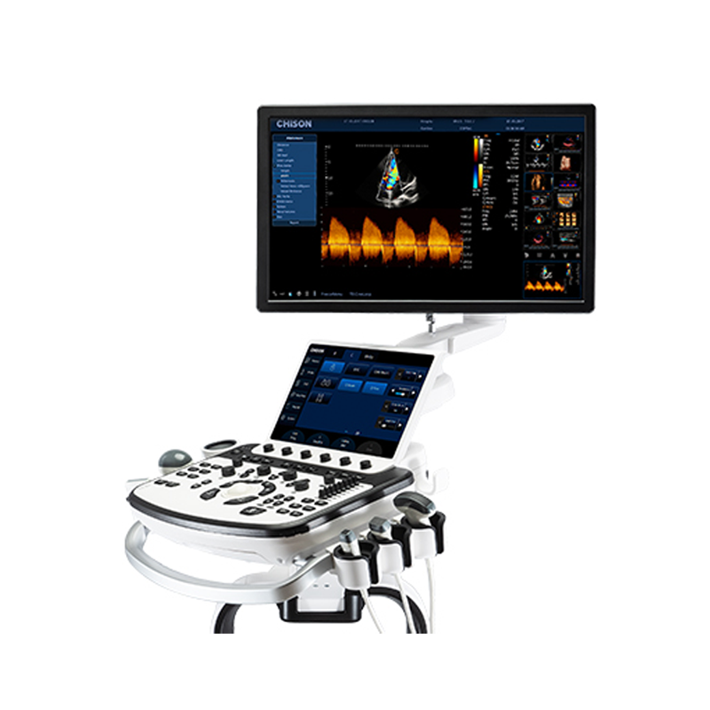 УЗИ сканер: как выбрать?!