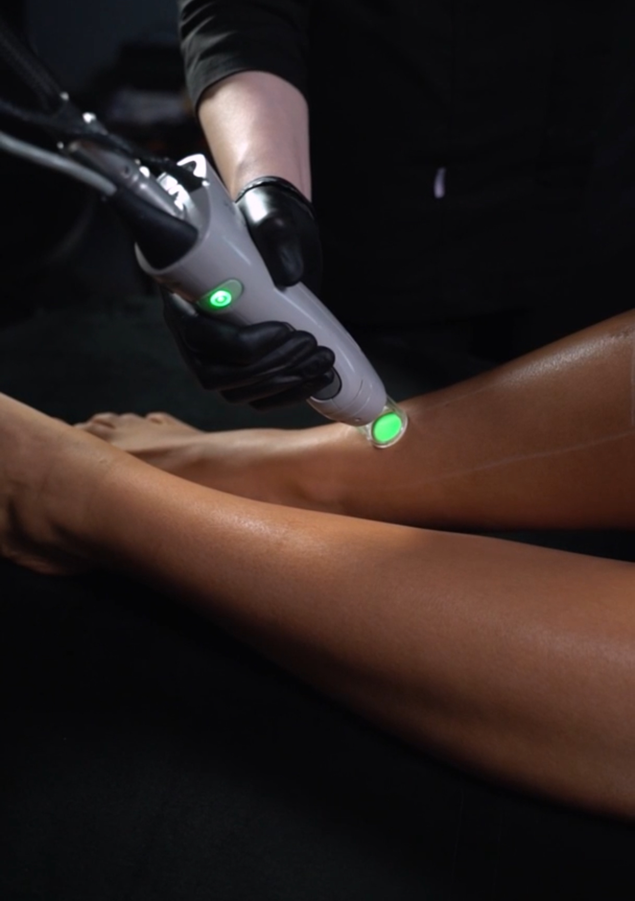 лазерная эпиляция ног летом в клинике Blvck Clinic Москва