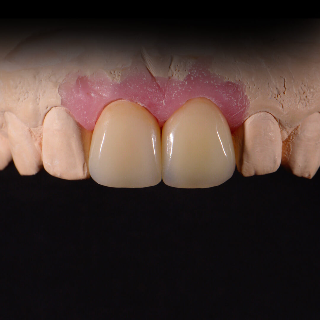 Зуботехническая лаборатория москва