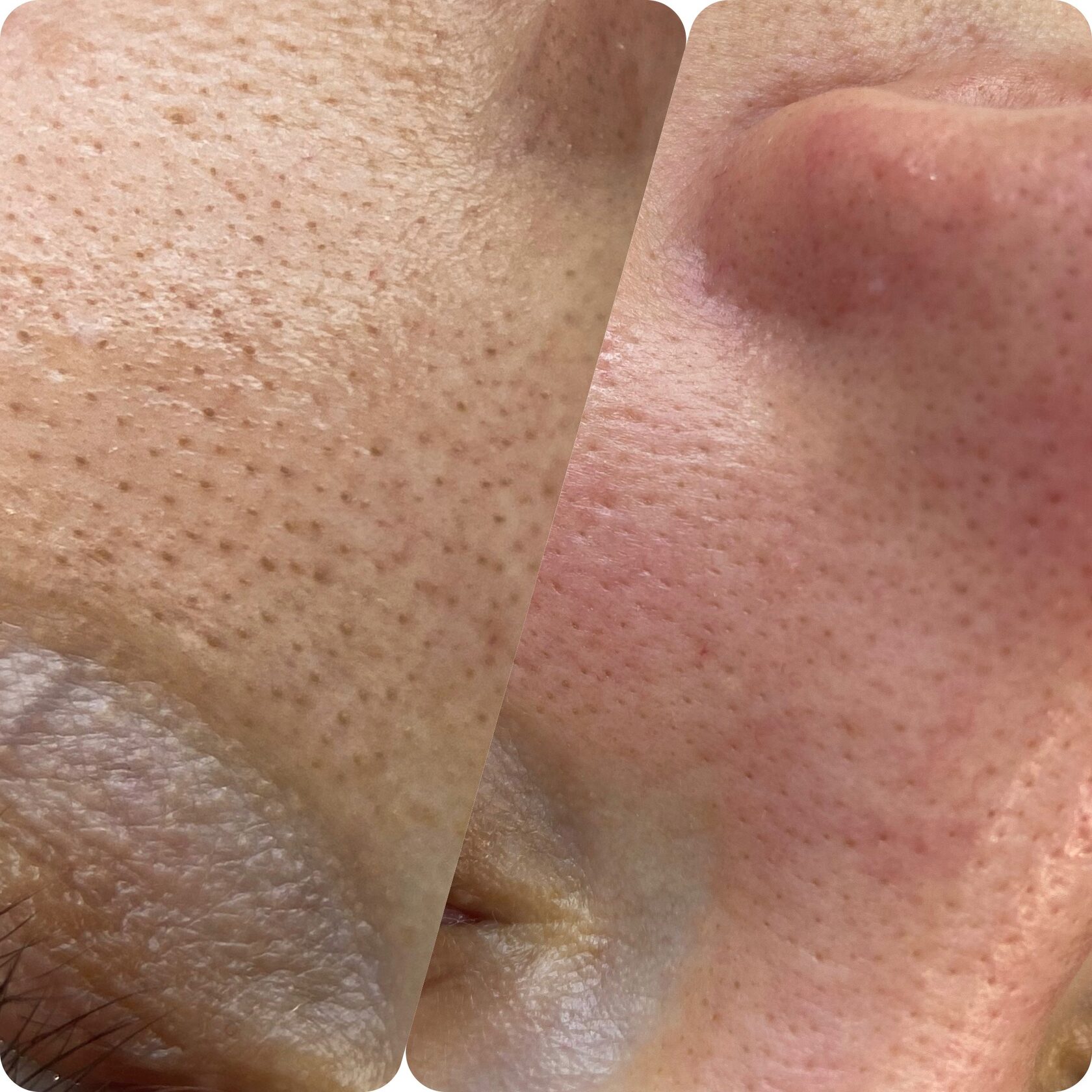 ДО/ПОСЛЕ ЭСТЕТИЧЕСКИХ ПРОЦЕДУР